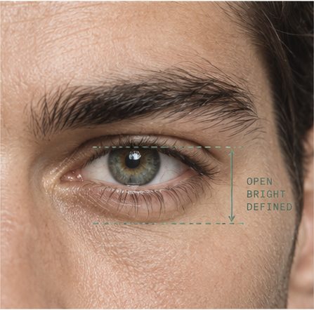 A close crop of an eye with the periorbital area measured and labelled open, bright, defined.